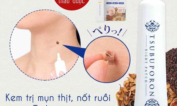 Kem trị mụn thịt, nốt ruồi Tsubuporon: Bí quyết cho làn da hoàn mỹ