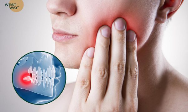 Mọc răng khôn sưng má: Làm gì để giảm sưng?