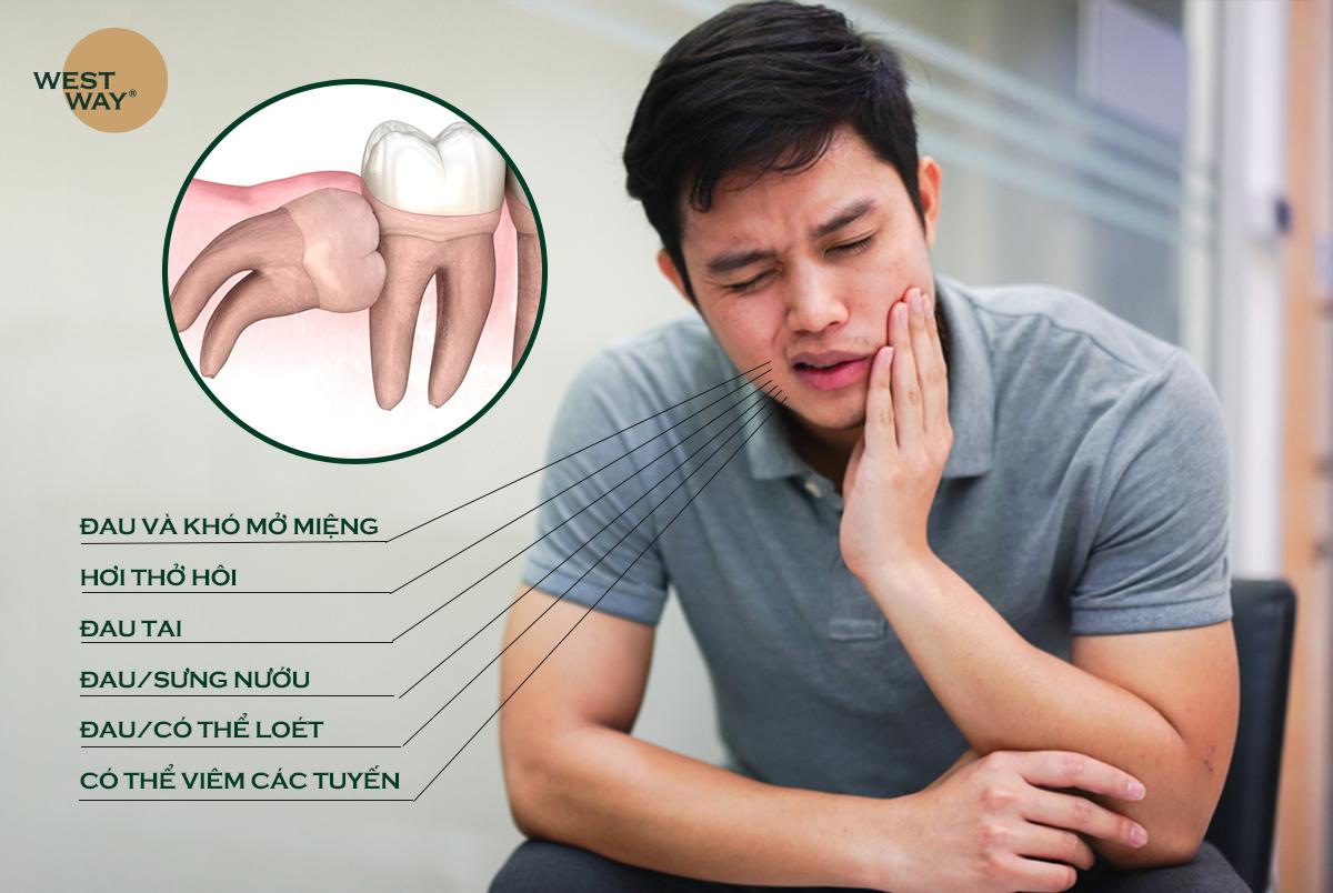Một số tác hại của răng khôn mọc gây sưng má