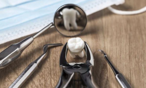Nhổ răng khôn: Phương pháp và chế độ ăn sau nhổ