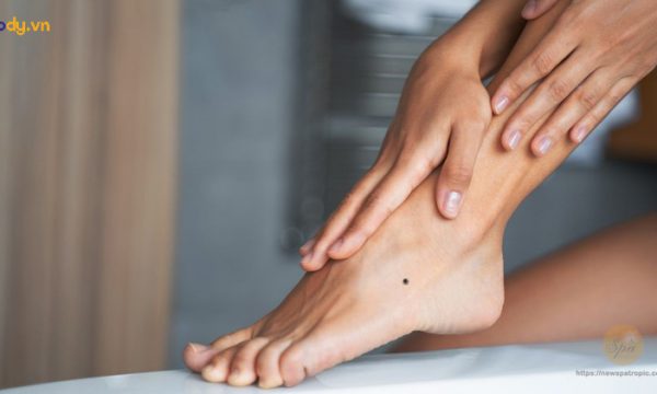 Nốt ruồi ở chân là tốt hay xấu? Ý nghĩa nốt ruồi trên bàn chân