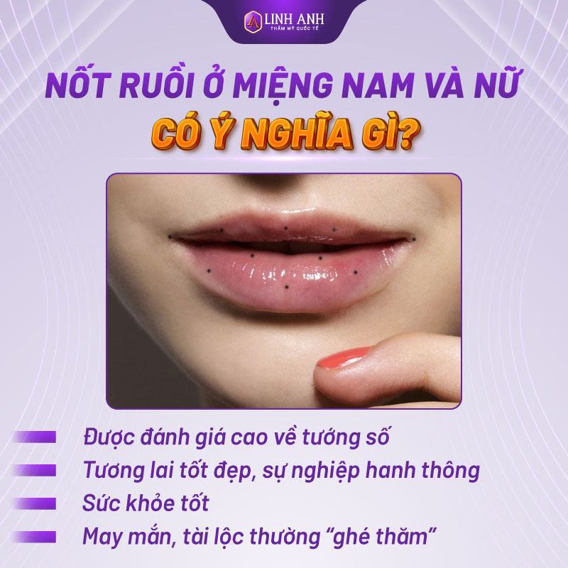 Nốt ruồi ở miệng nam và nữ có ý nghĩa gì?