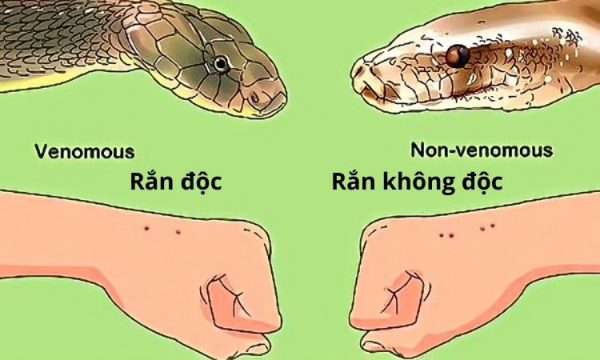 Nhận biết và Cách sơ cứu khi bị rắn độc cắn